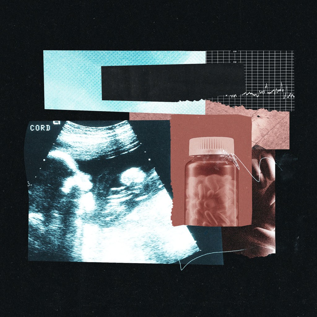 A collage of an ultrasound scan, a bottle of pills, and medical graph lines.