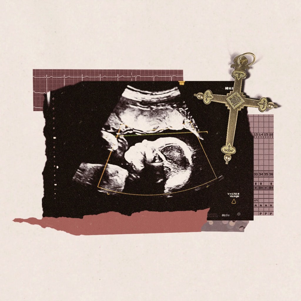 A fetal ultrasound image layered with cardiac monitor lines and a gold cross.