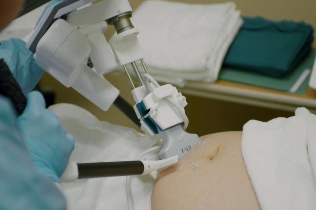 A robotic arm remotely controlled by a sonographer hours away in Saskatoon scans a patient.