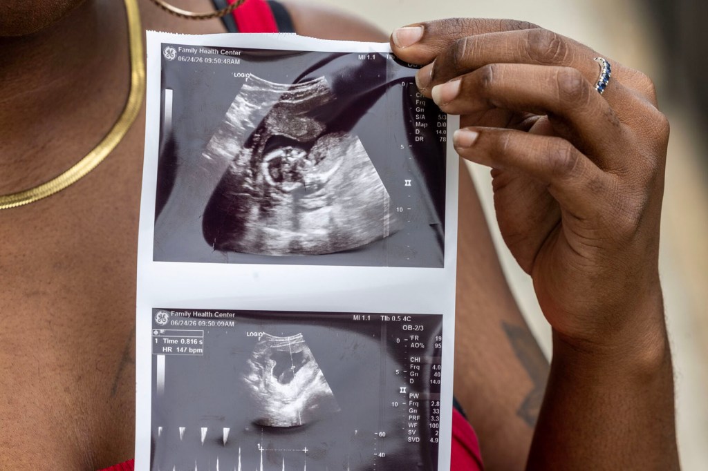 A person holds up two printed ultrasound images showing a fetus.