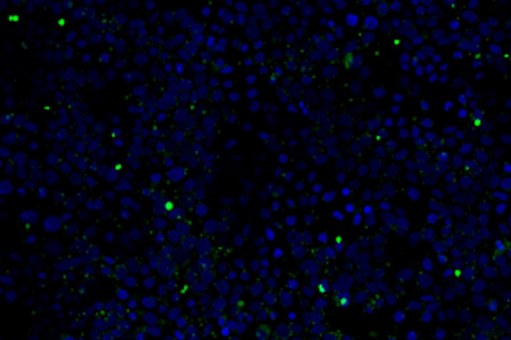 A visualization of PVC nanoplastics in placental cells, with cell nuclei shown in blue and nanoplastics in green.